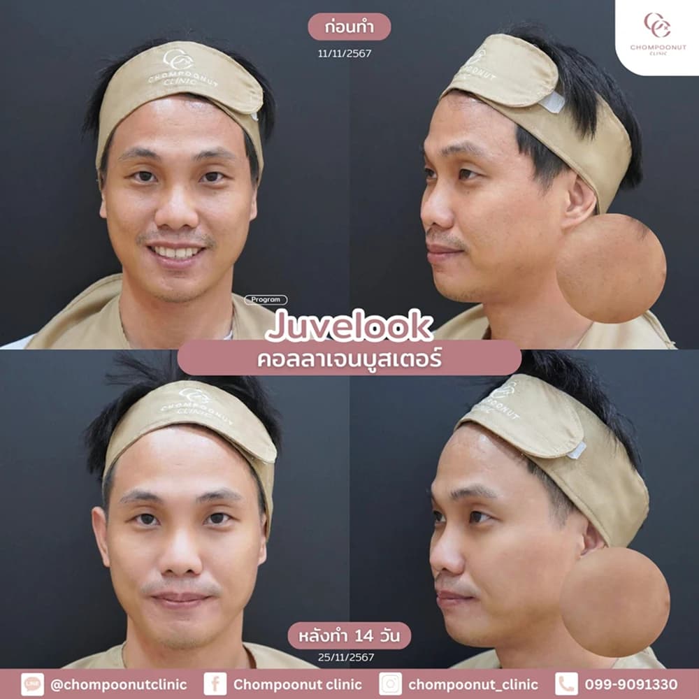 Review โปรแกรม Juvelook 2
