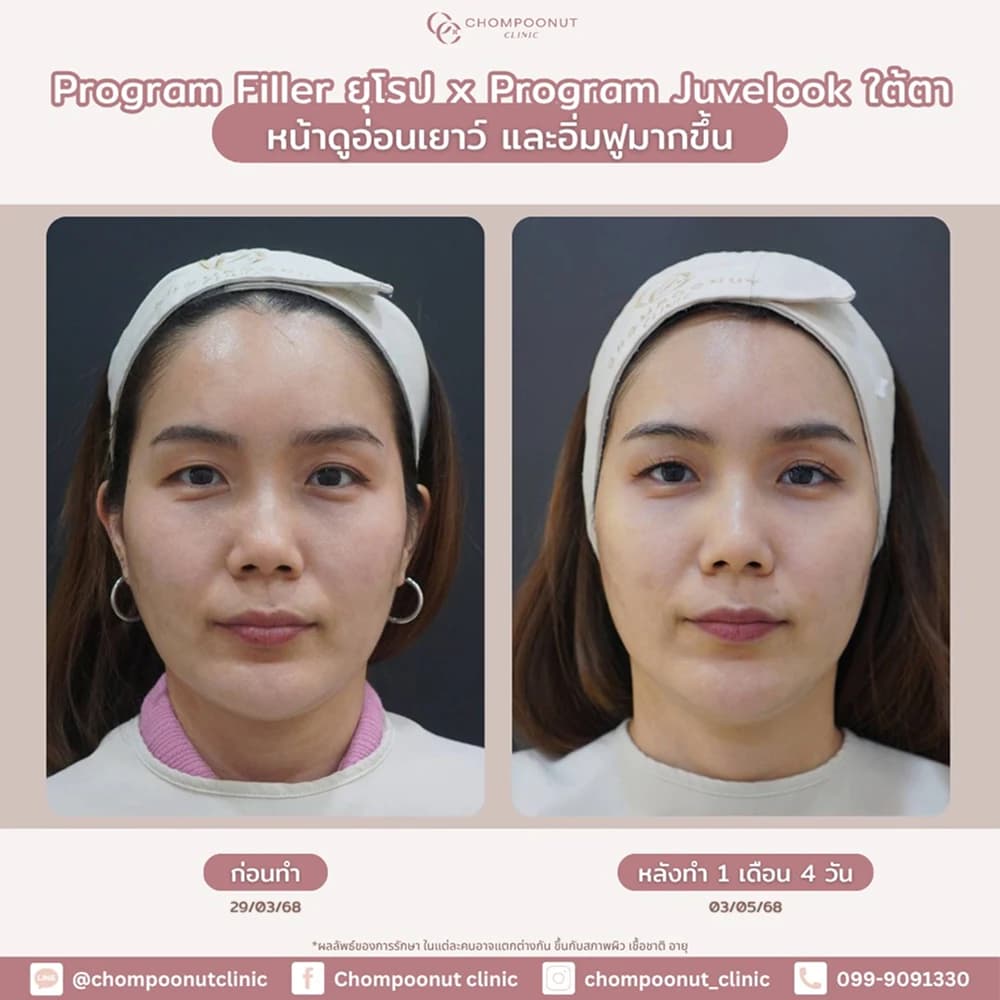 Review โปรแกรม Juvelook 3