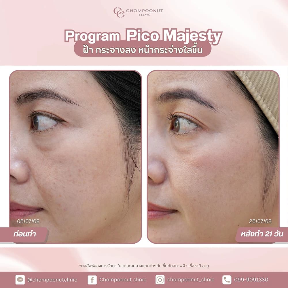 Review โปรแกรม Pico 2