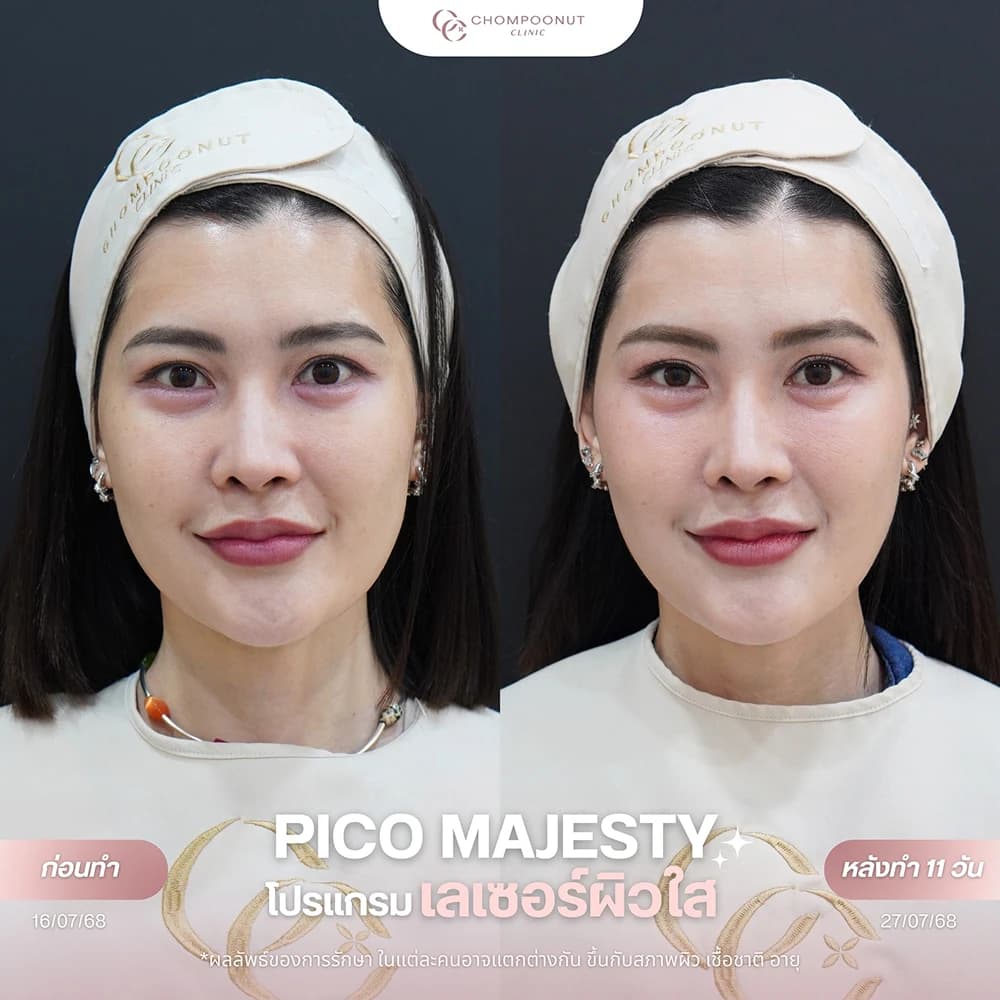 Review โปรแกรม Pico 6